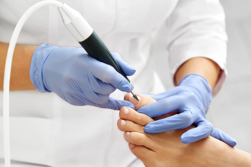 Pedicure curativo professionale